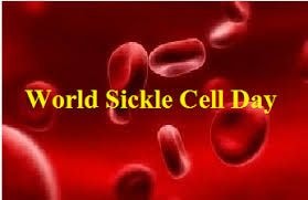 Editorial : Sickle cell patients suffer undue stigmatization